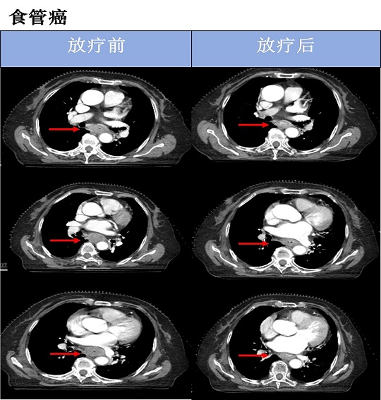 食管.jpg